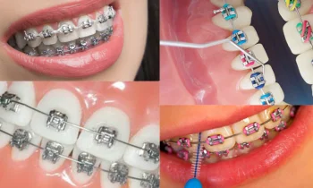 Diş Teli Kullanımı: Sağlıklı Dişler İçin Önemli Bir Adım